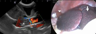 Primary extraskeletal osteosarcoma of the post-hepatic caudal vena cava in a dog—Case report